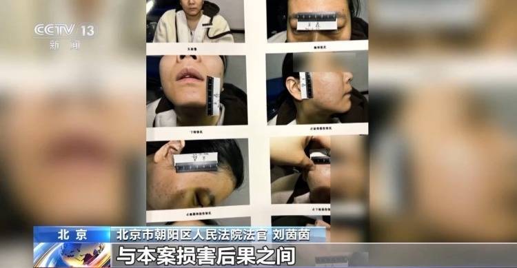 皇冠信用网代理占成
_打美容针竟致十级伤残皇冠信用网代理占成
!在医生家中做医美 出了事谁负责?