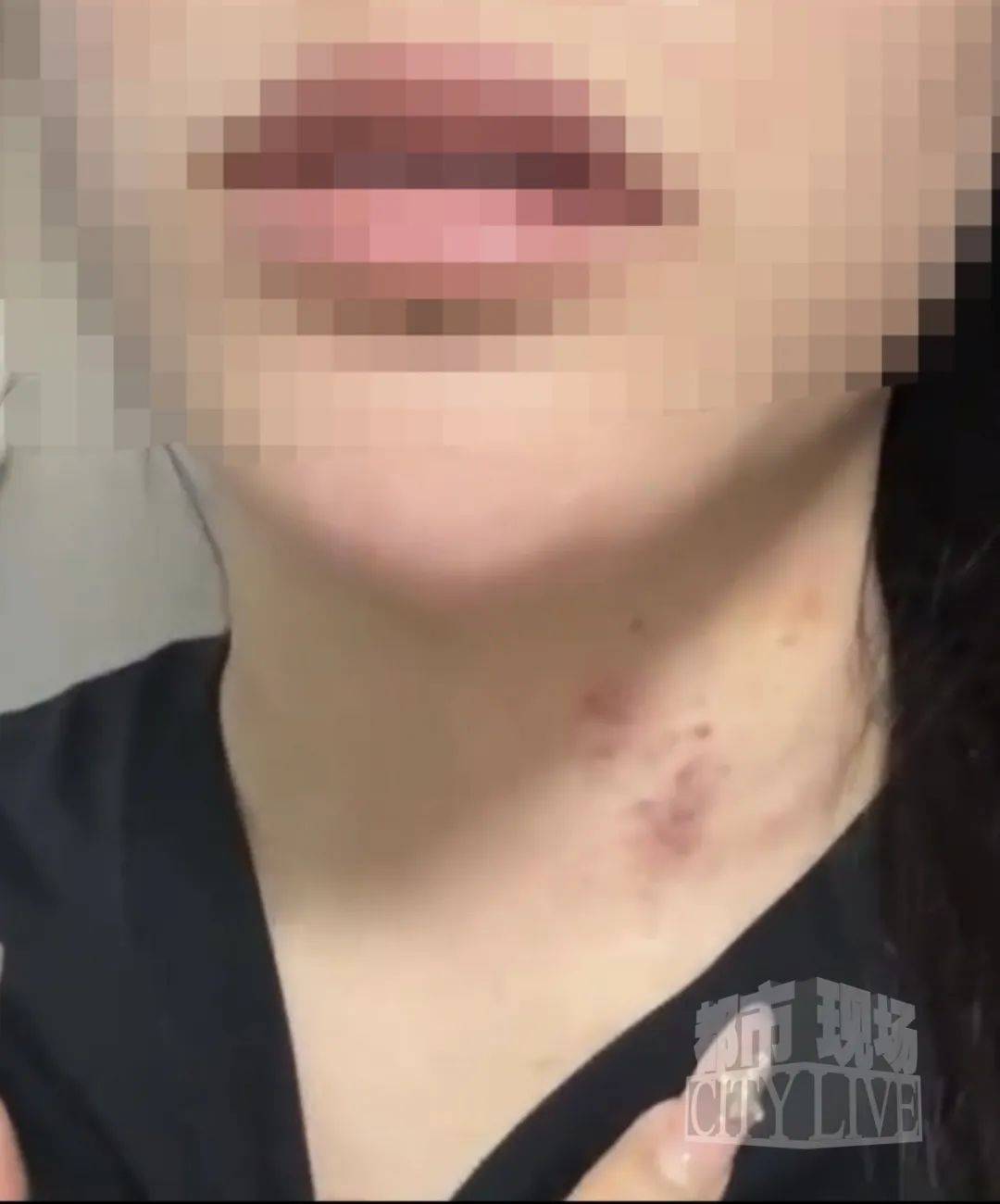 皇冠信用網最高占成_湖南衡阳29岁女子疑被男友施暴后从25楼跳下身亡 男友徐某此前还刺激说：“你放心皇冠信用網最高占成，她不会去死的”