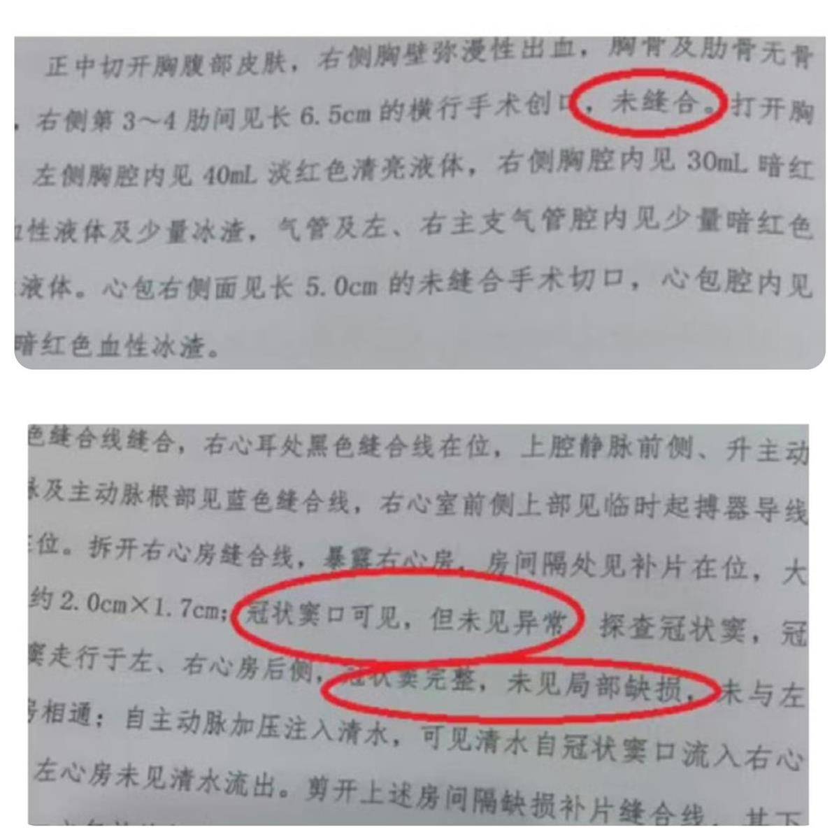 皇冠信用网登2
_宁波夭折女婴小洛熙部分尸检报告公布皇冠信用网登2
,显示6.5厘米创口未缝合,父亲:会择期公布完整报告